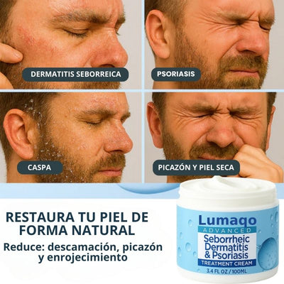 LUMAQO - Piel limpia sin caspa ni escamas